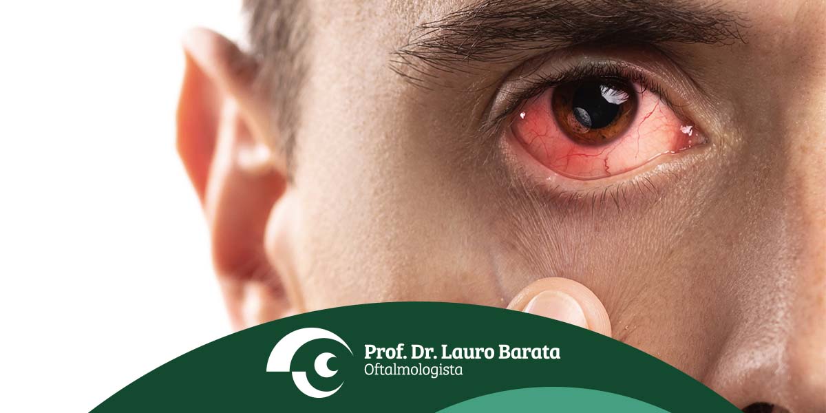 Homem com conjuntivite - site Dr. Lauro Barata Oftalmologista de Belém - PA